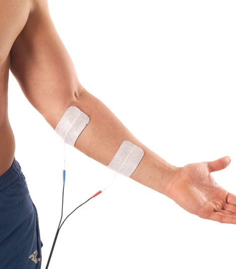 Omge armbgen med elektroder vid behandling av tennisarmbge. Detta kar genombldningen s att inflammationen kan lka.