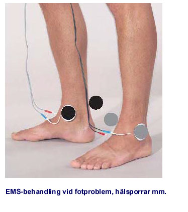 Elterapi för behandling av inflammationer i vävnader