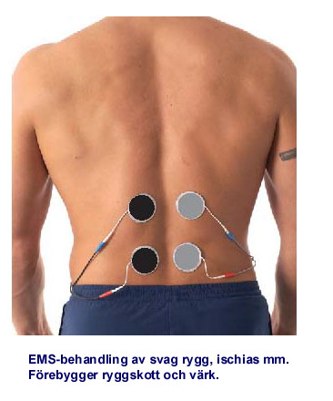 Nr du strker upp ryggens muskler med elektrisk muskeltrning s minskar trycket mellan kotorna. Risken fr nervklmning minskar d ocks.